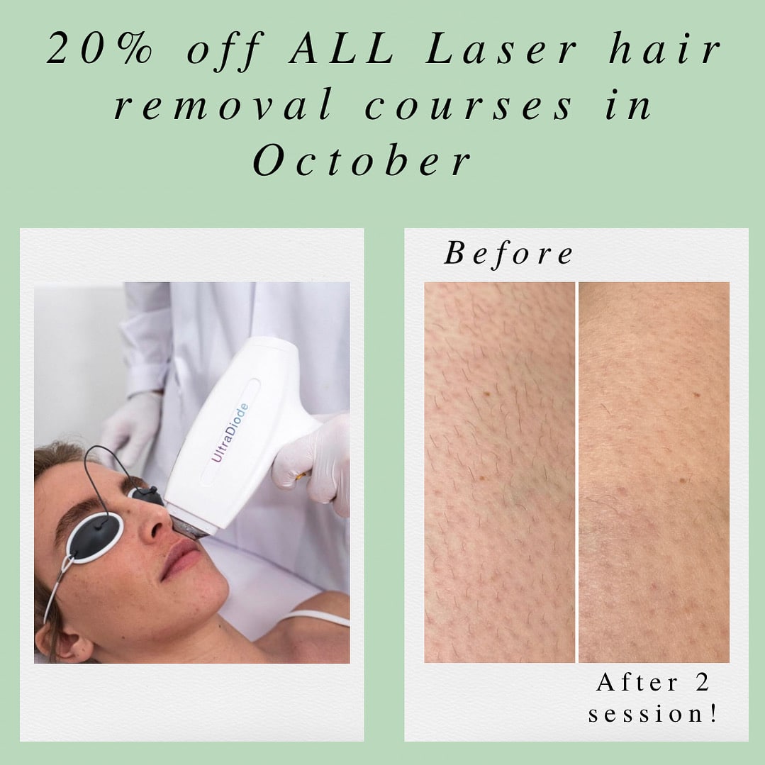 20% off ALL Laser hair removal courses in October