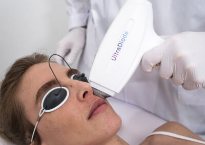 NEW Ultradiode Laser Hair Removal