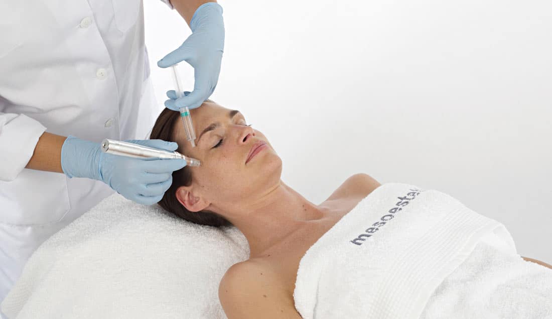 Microneedling at The Beauty Centre 005