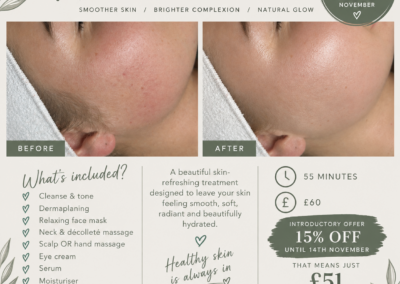Introducing our NEW Dermaplaning Treatment